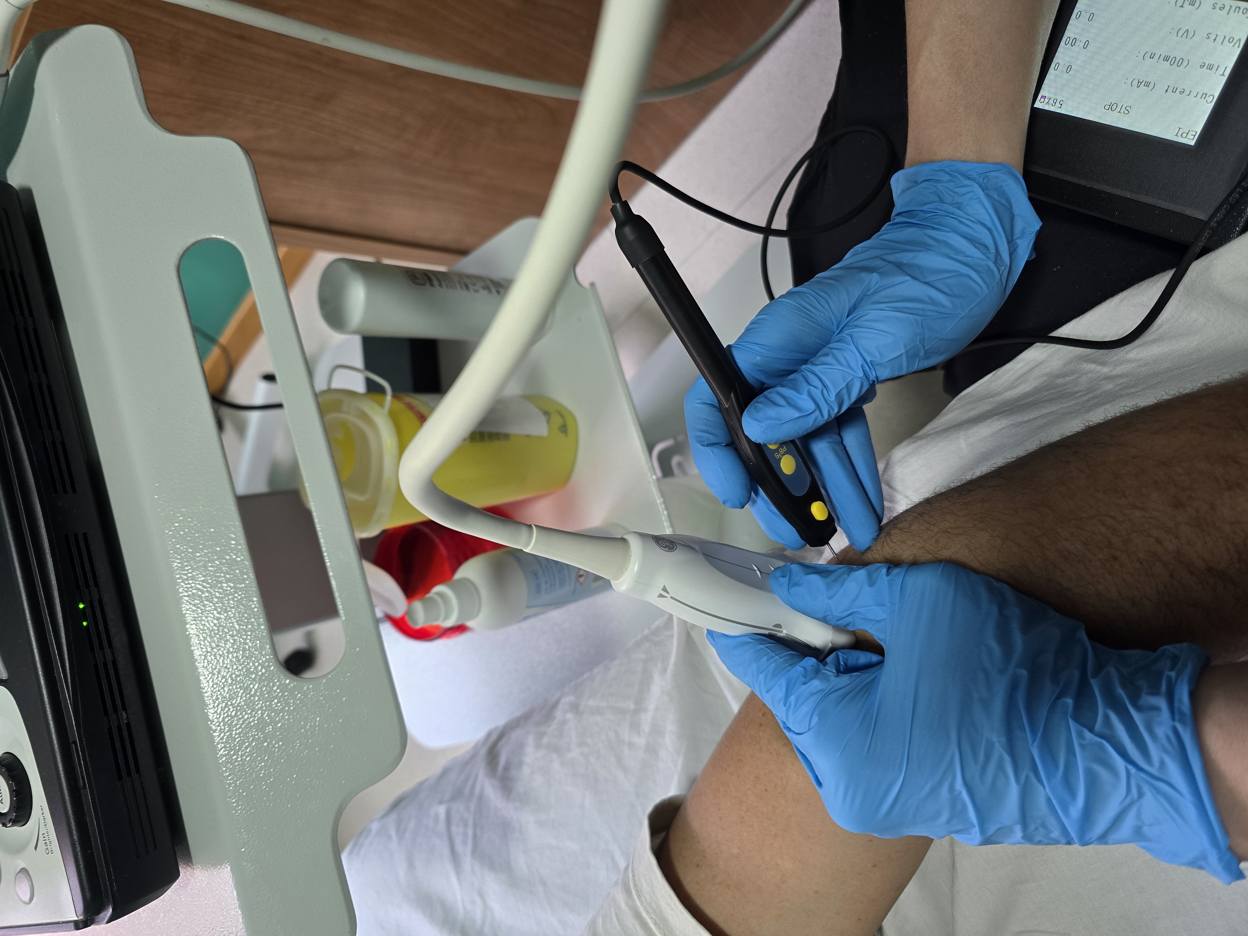 electroterapia fisioterapia